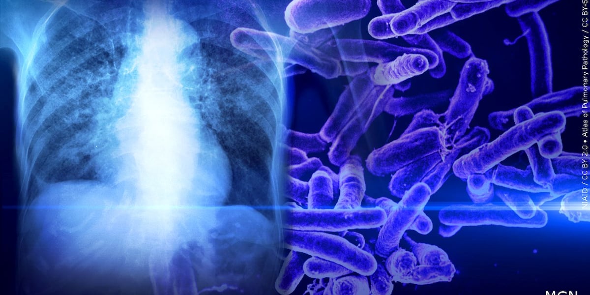 ‘Individual’ tests positive for tuberculosis at high school in Lincoln ...