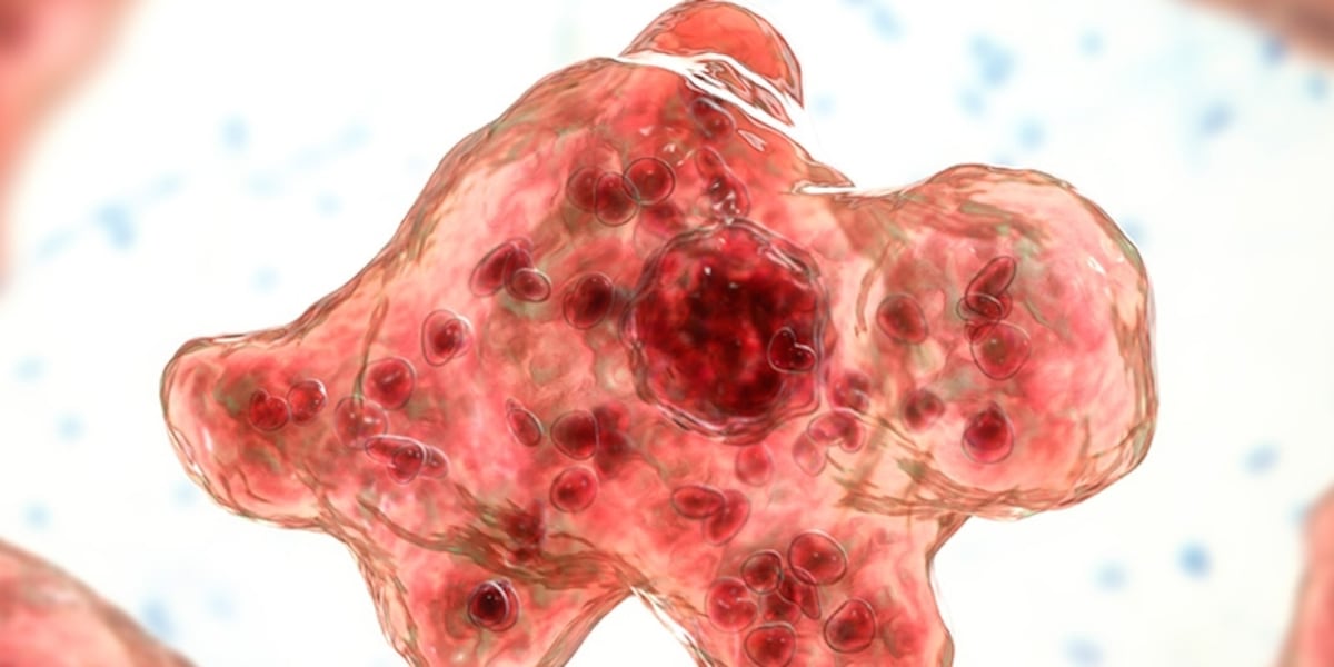 Photo: wbtv.com NC Teen Dies From Brain-Eating Amoeba